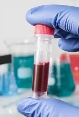  Diabetes: exames de rotina previnem agravamento da doença