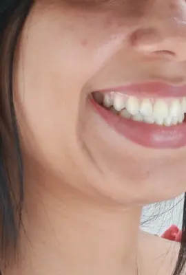 Be Natural: retorno à beleza original é a nova tendência 