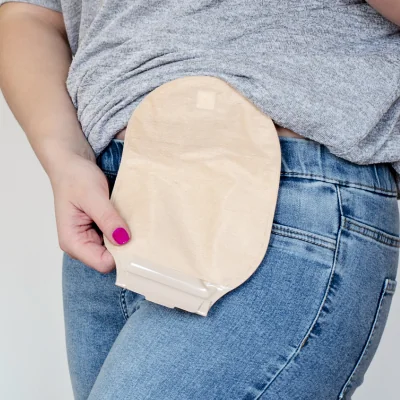 Ostomia: confira dicas para o manuseio correto do procedimento que salvou a vida da cantora Preta Gil 